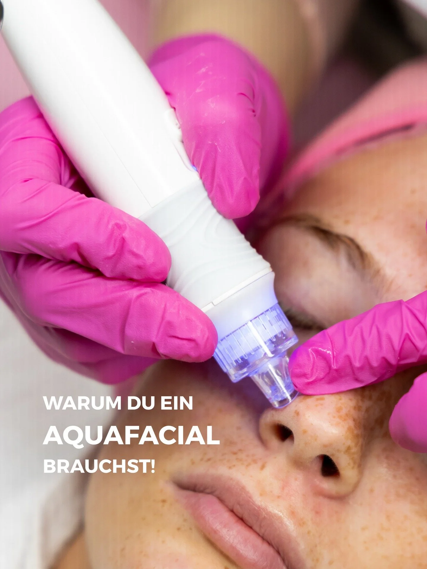 Aquafacial bietet dir einen sofort sichtbaren glow - aber vergesst nicht, Gesichtsbehandlungen sind ein Prozess, desto &ouml;fter und regelm&auml;&szlig;iger du sie machst, umso bessere Ergebnisse sind sichtbar!🩷

Schreib mir gerne eine DM, wenn du 