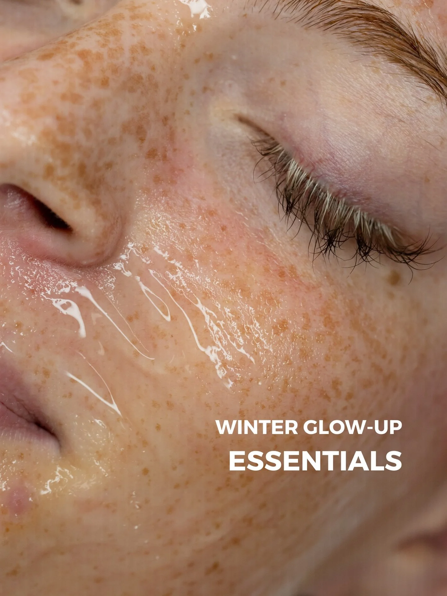 Winter ist die perfekte Zeit f&uuml;r dein Beauty Glow-Up! Welche Treatments stehen auf deiner Liste?🩷

Schreib mir gerne eine DM, wenn du einen Termin bei mir ausmachen m&ouml;chtest oder nutze den Link in meiner Bio!🧚🏼&zwj;♀️ 

#girlsclubbynicky