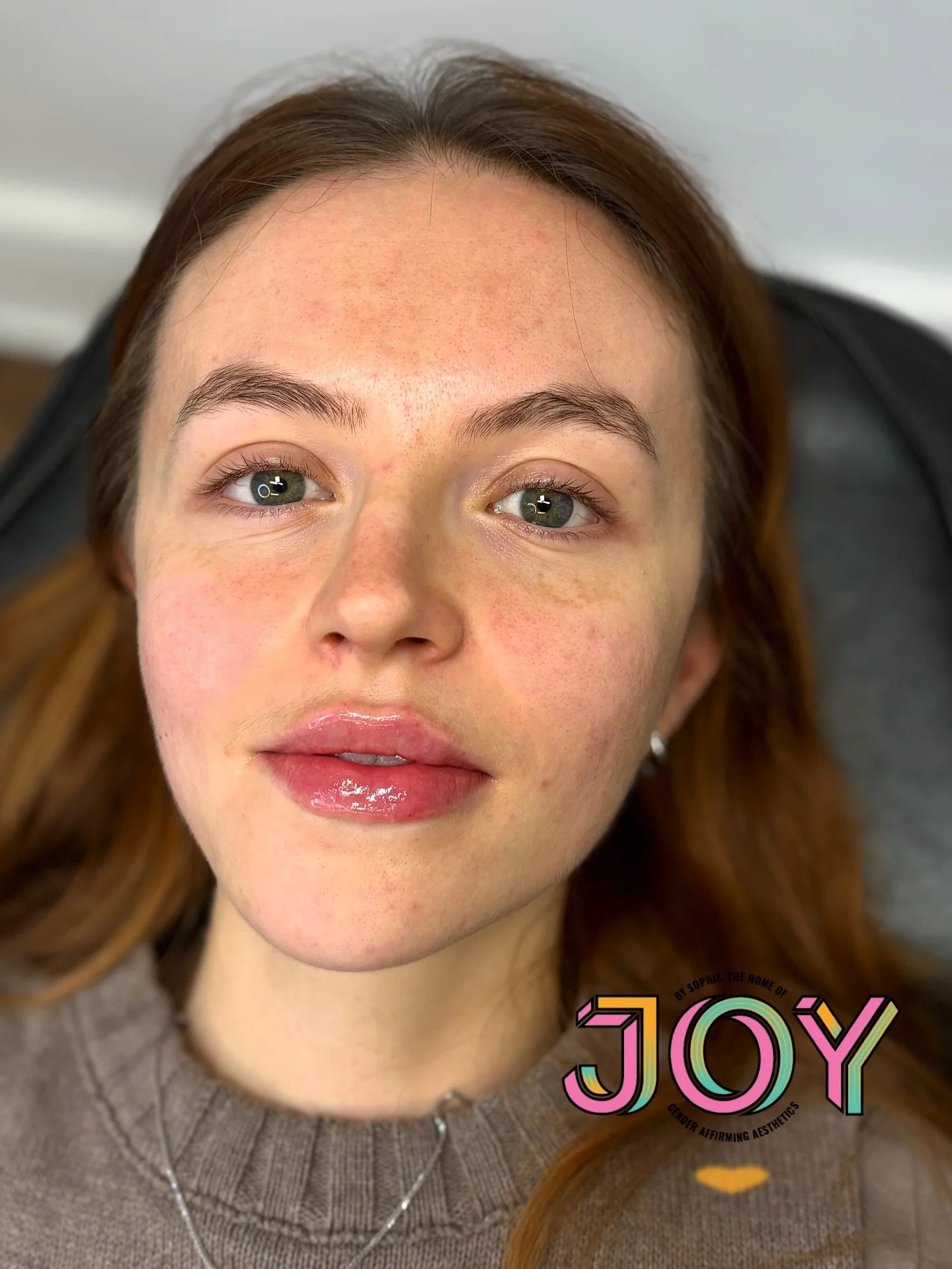 Lip enhancement of dreams from this week in clinic 💫 💕💉 Happy friday my loves 🫶🏼

Please book your appointments early as my diary is getting super busy towards the end of the year. Thank you SO MUCH for keeping me so busy, life is but a dream 💭