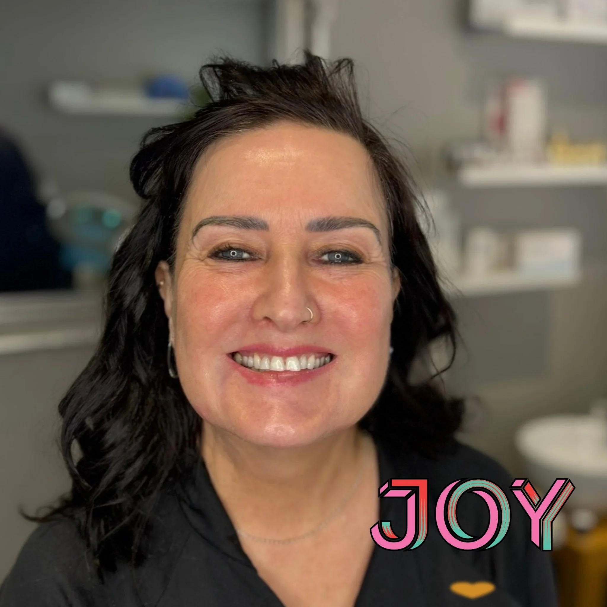 A Subtle, Sculpted Refresh at 64: Full Face Rejuvenation Case Study