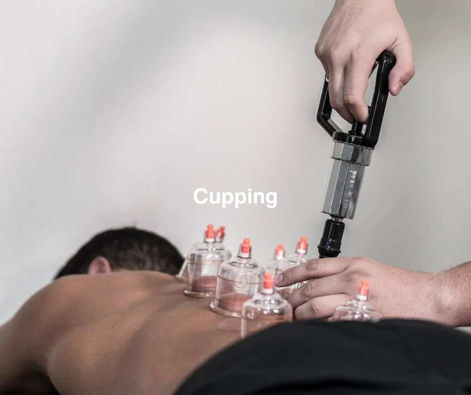Sports Massage Therapist applying cupping to clients back