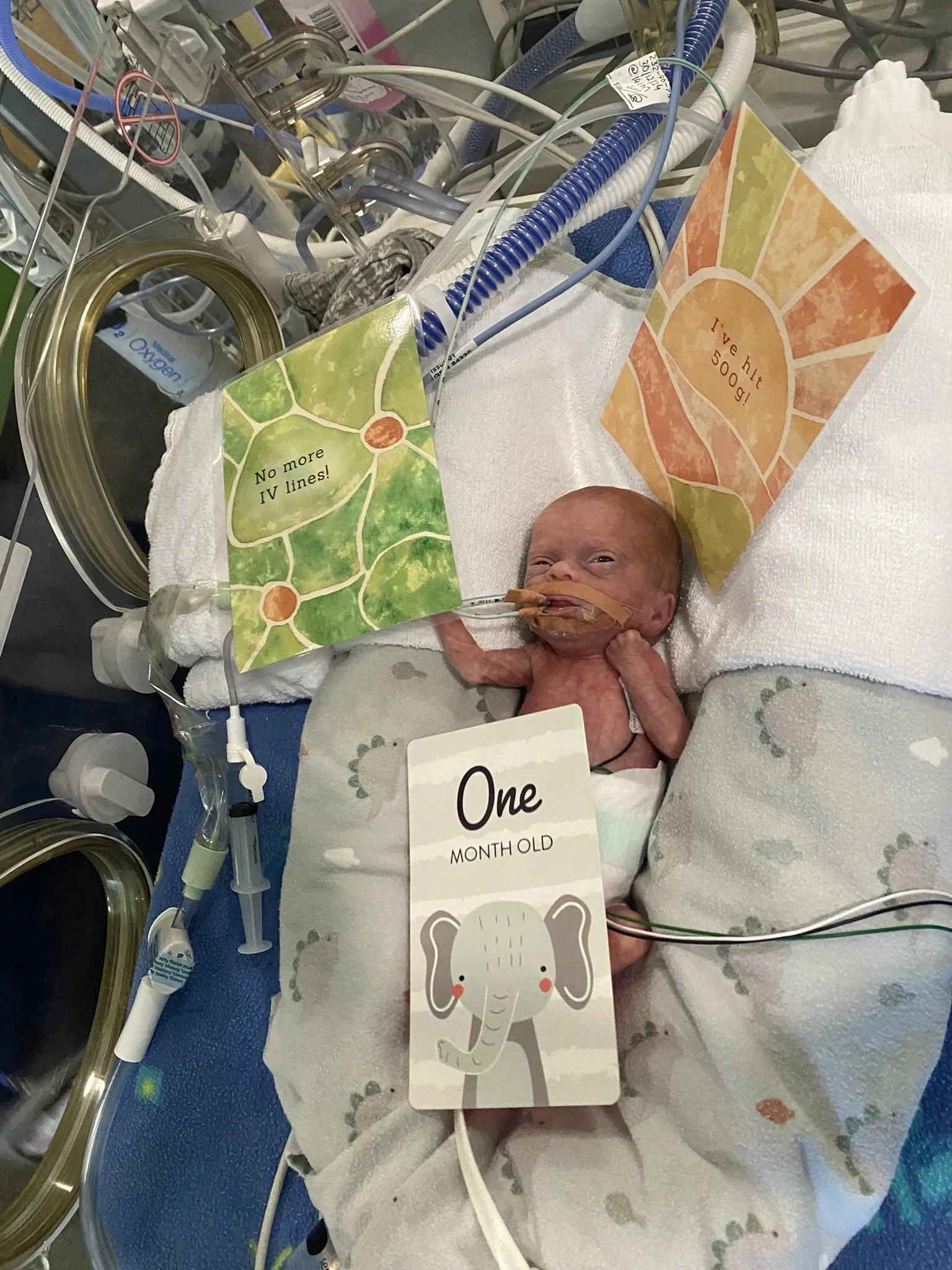 NICU Redefines What a Milestone Looks Like