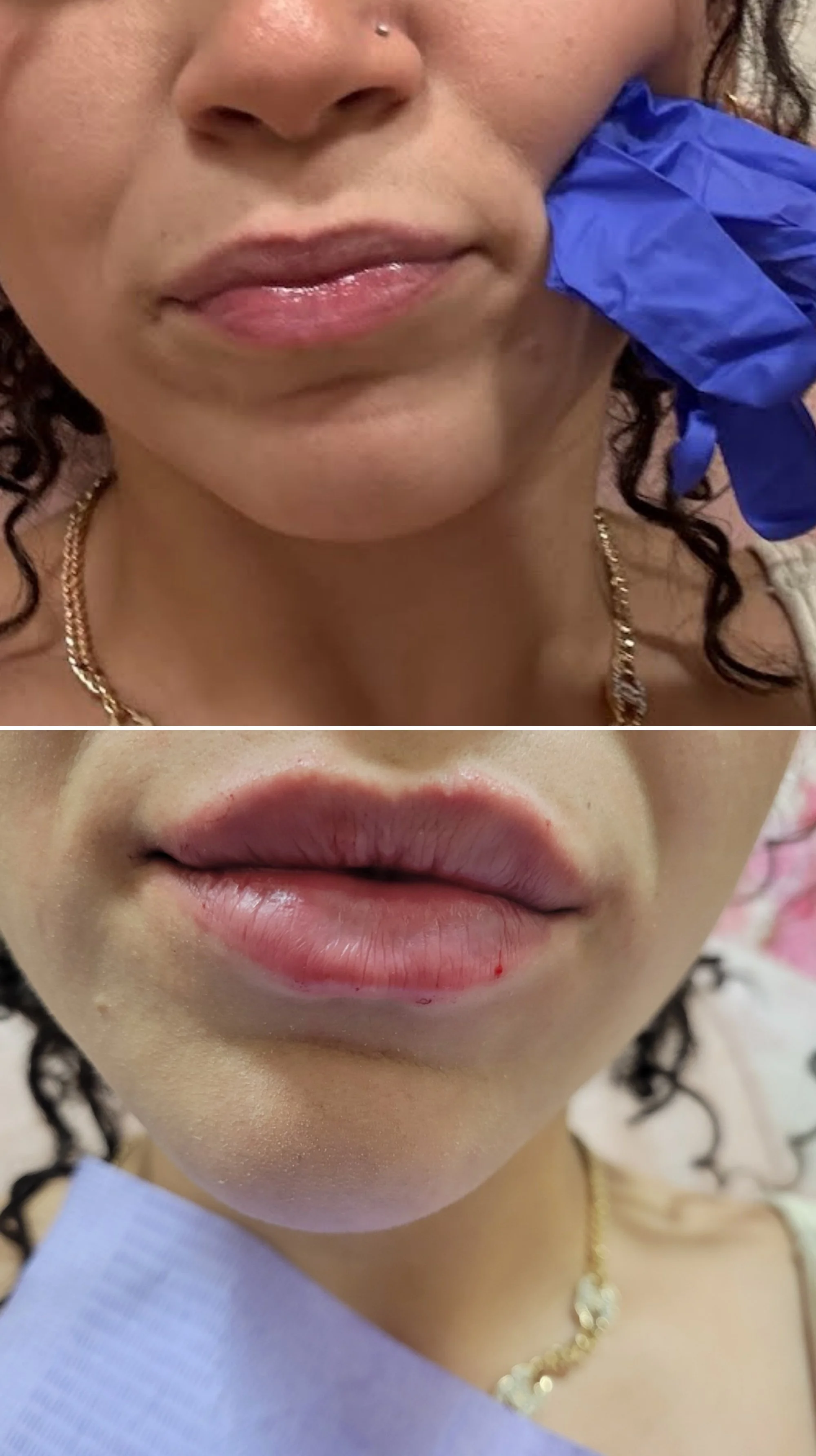 revanasse kisse