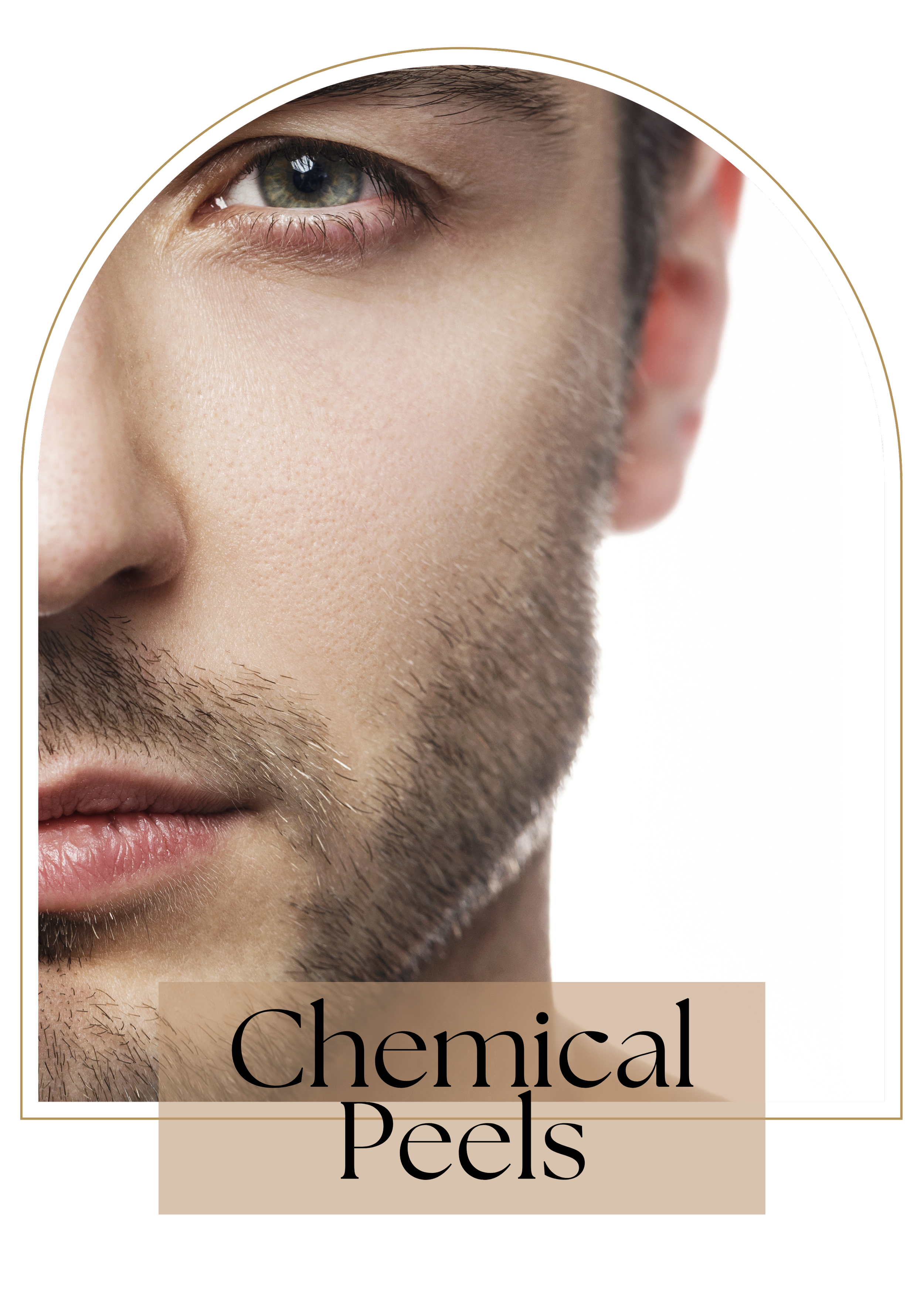 Chemical peels at Diverse Aesthetics, Richmond, VA 23260