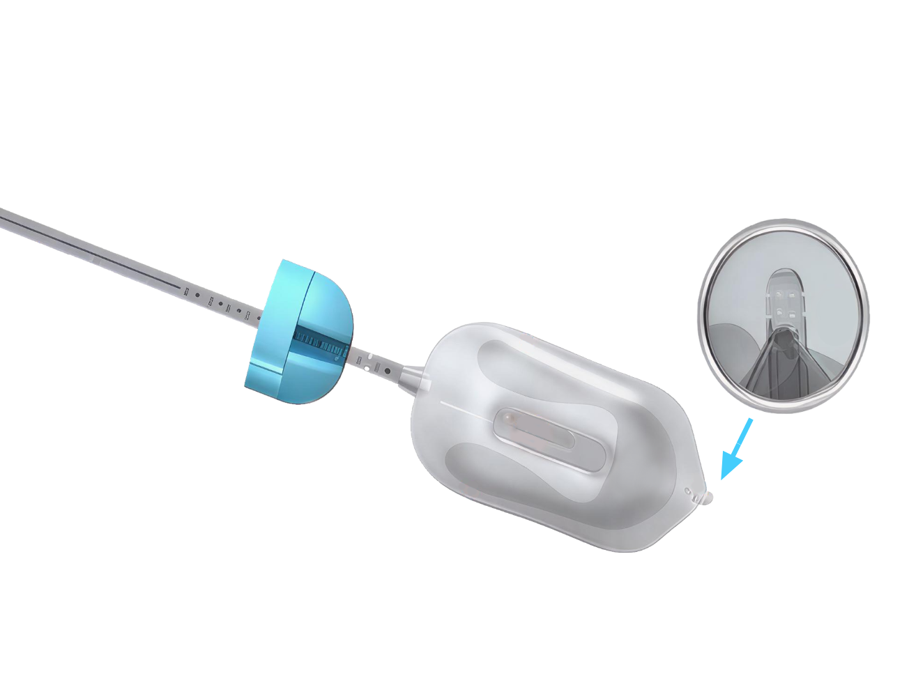 RadiaDyne's oncology tools feature solutions for advanced for prostate and ovarian cancer treatment.