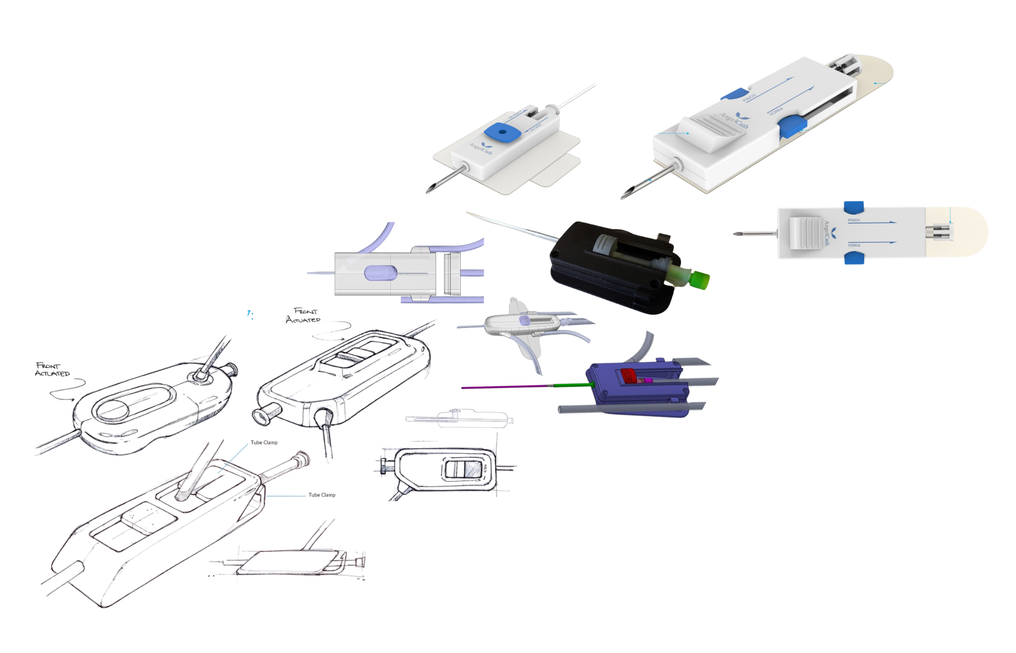 Medical Device Development Process: From Concept to FDA Approval