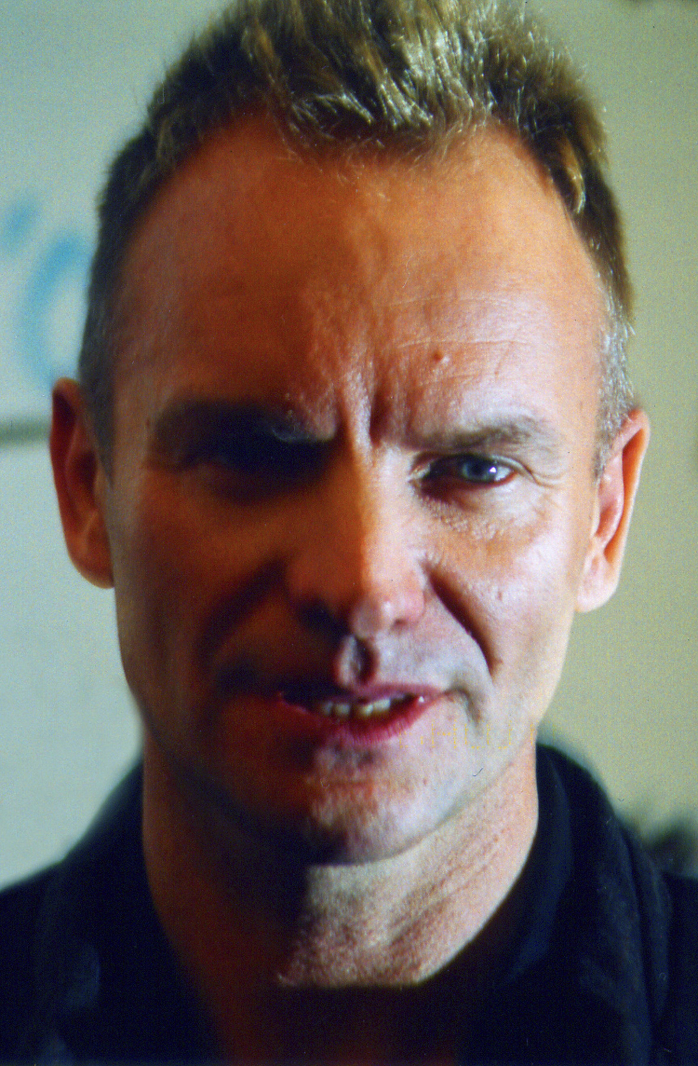 Sting