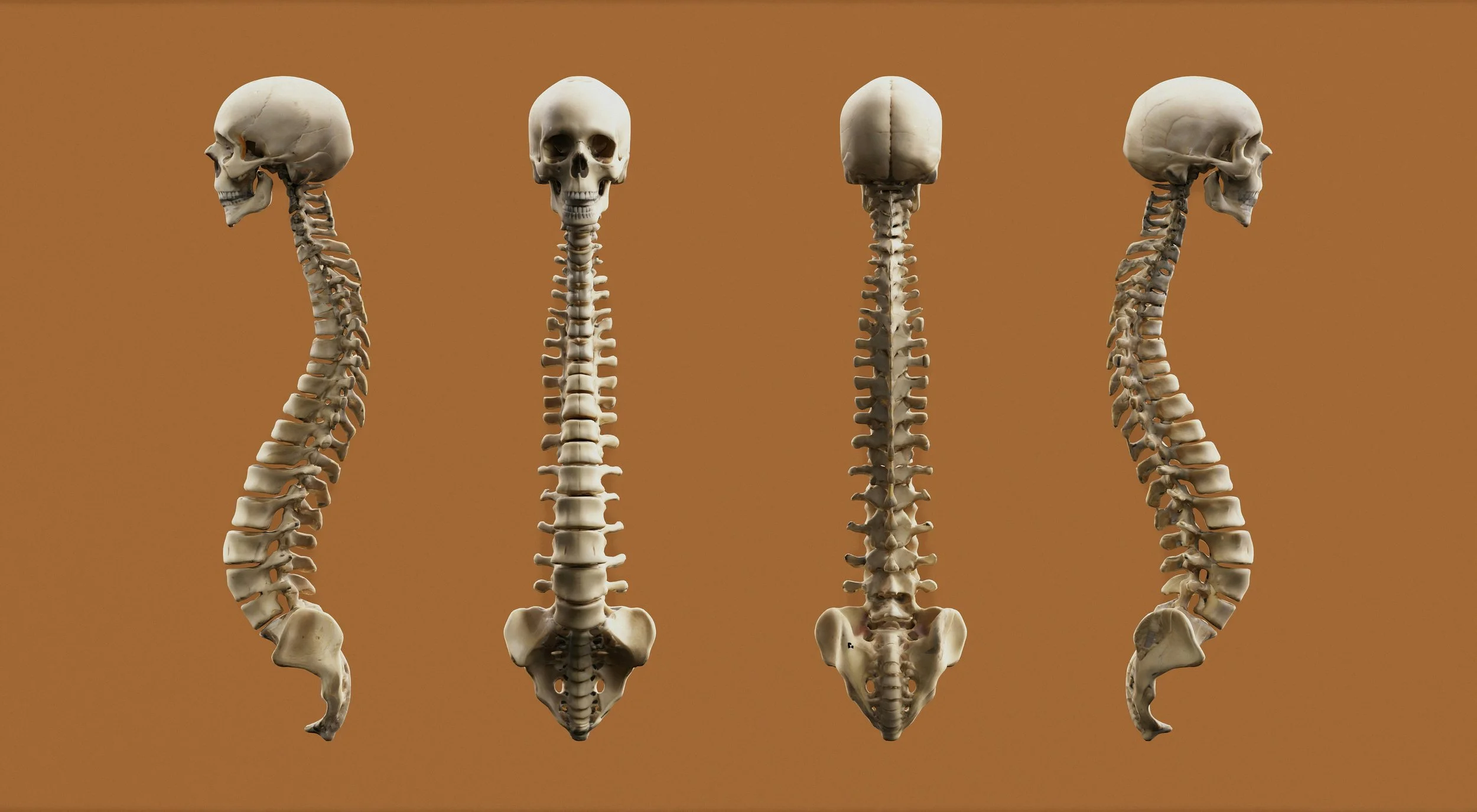 What is Osteoporosis, Exactly?
