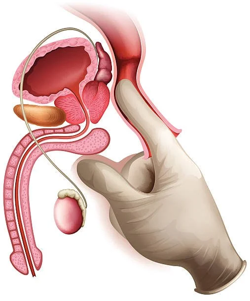 Medical illustration showing a hand inserting a finger into the male urethra with a catheter in place, illustrating male urinary and reproductive anatomy.