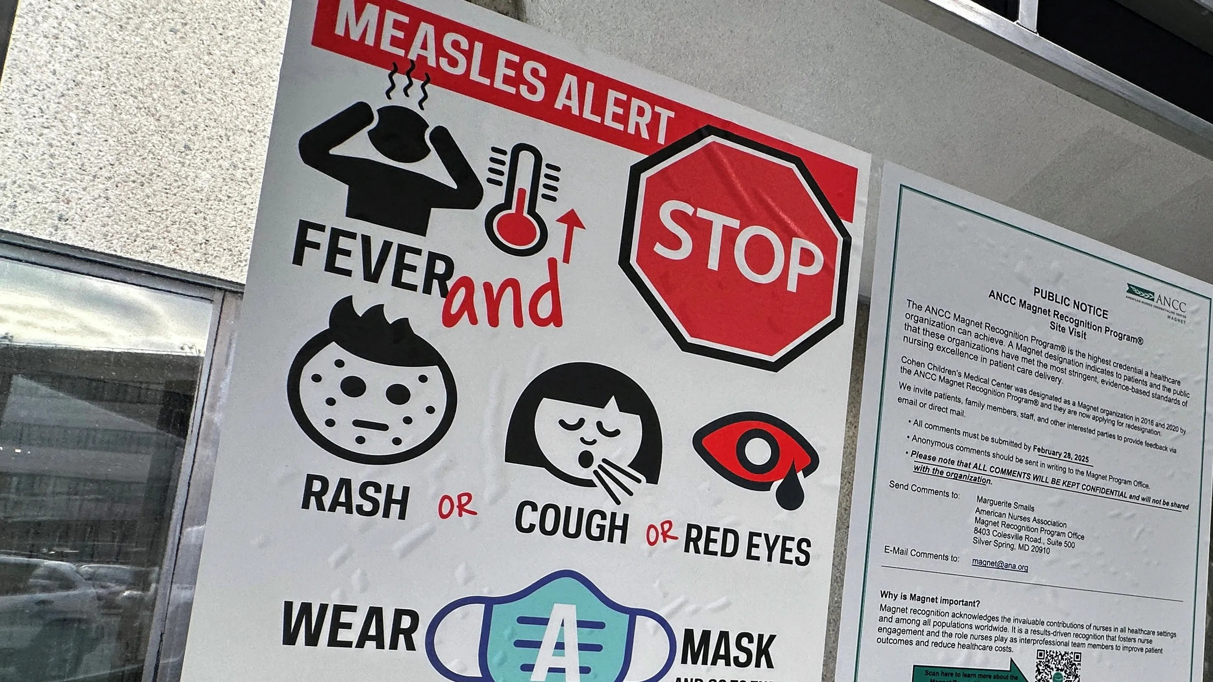 National Alert Over Measles Surge.