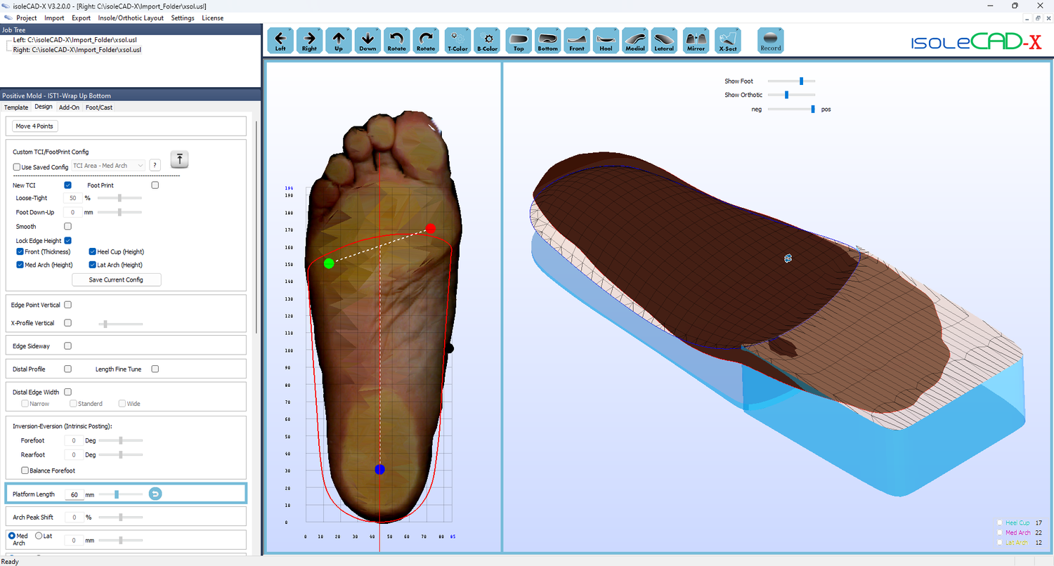 isoleCAD-X — 3D Foot Scanners, Foot Pressure Plate, Insole Design/Shoe ...