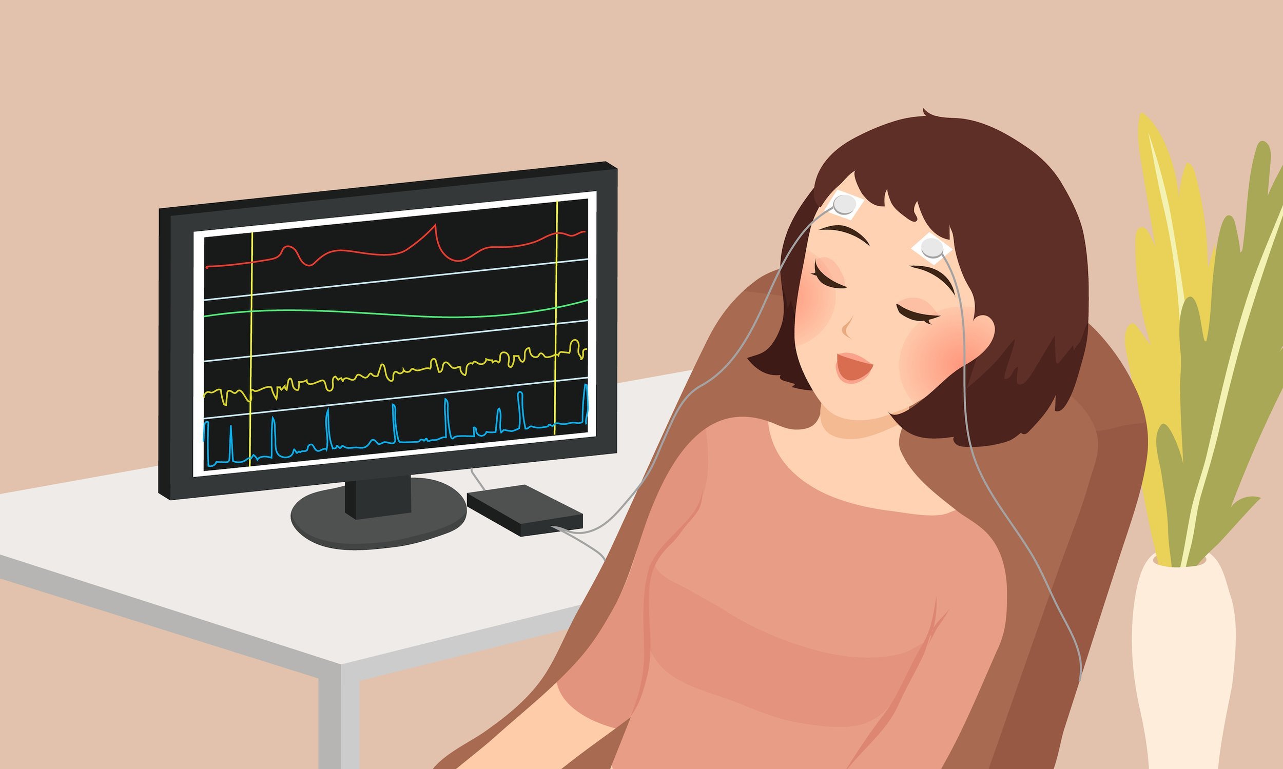 What is Neurofeedback Therapy?