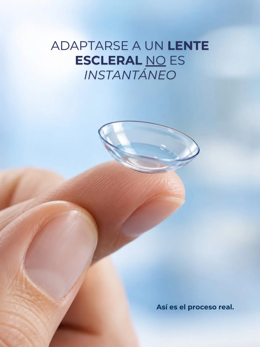 Adaptarse a un lente escleral no es instant&aacute;neo, y est&aacute; bien que as&iacute; sea: es un proceso que se ajusta a cada c&oacute;rnea, no al rev&eacute;s.

Si ya sab&eacute;s que esta es tu opci&oacute;n de tratamiento pero no sab&eacute;s 
