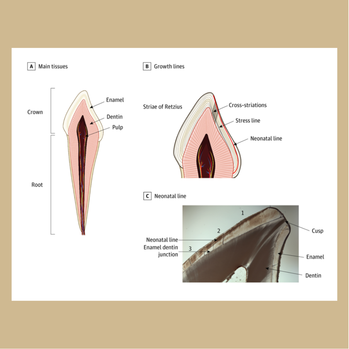 Tooth diagram
