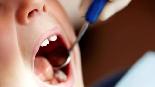 Child at the dentist with their mouth open