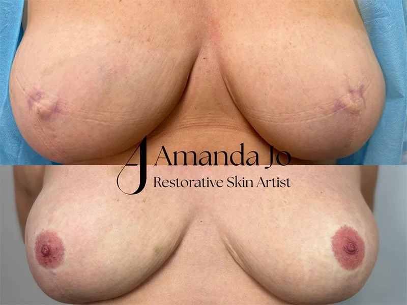 Second 3D Realistic areola tattoo client by Amanda Jo Newcastle
