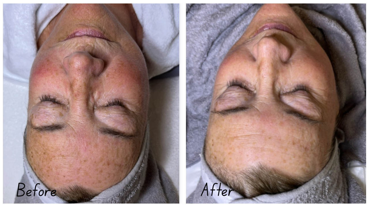 Before and After Youtube Thumbnail Cityscape (2).png