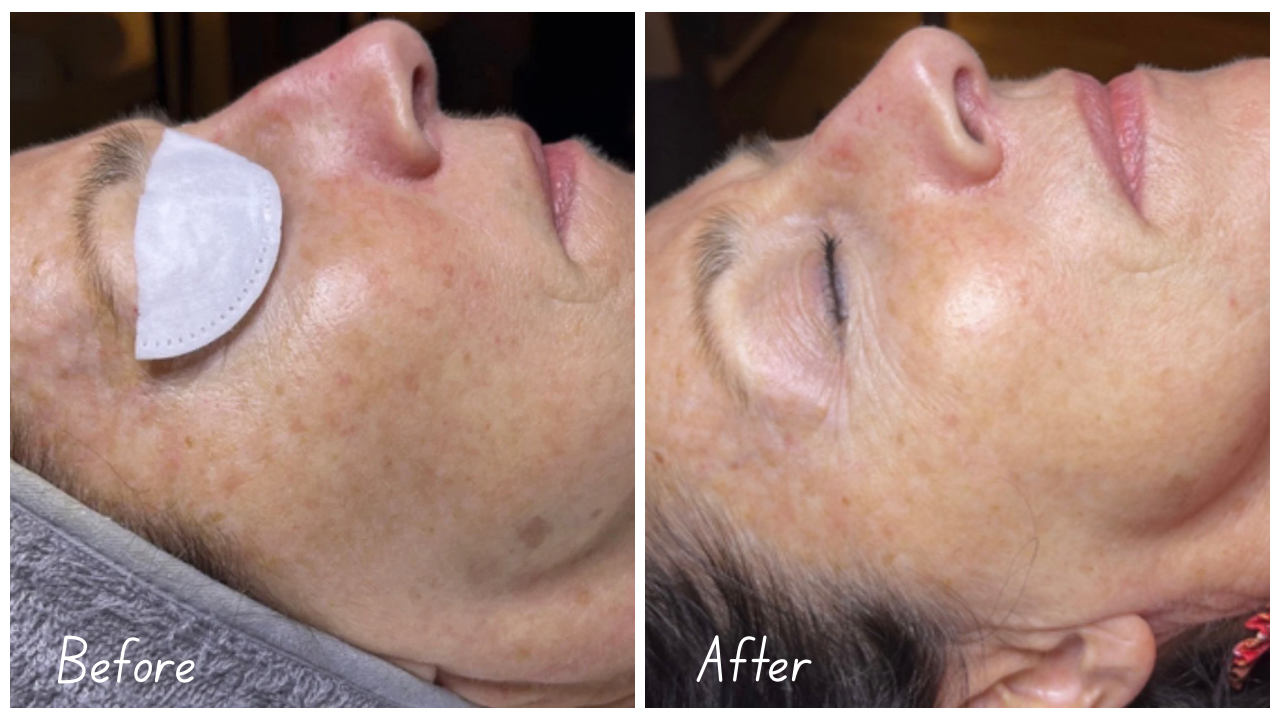 Before and After Youtube Thumbnail Cityscape.png