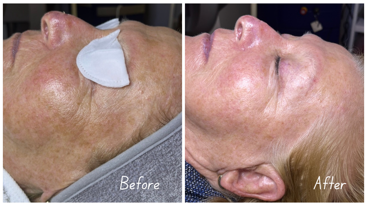 Before and After Youtube Thumbnail Cityscape (3).png