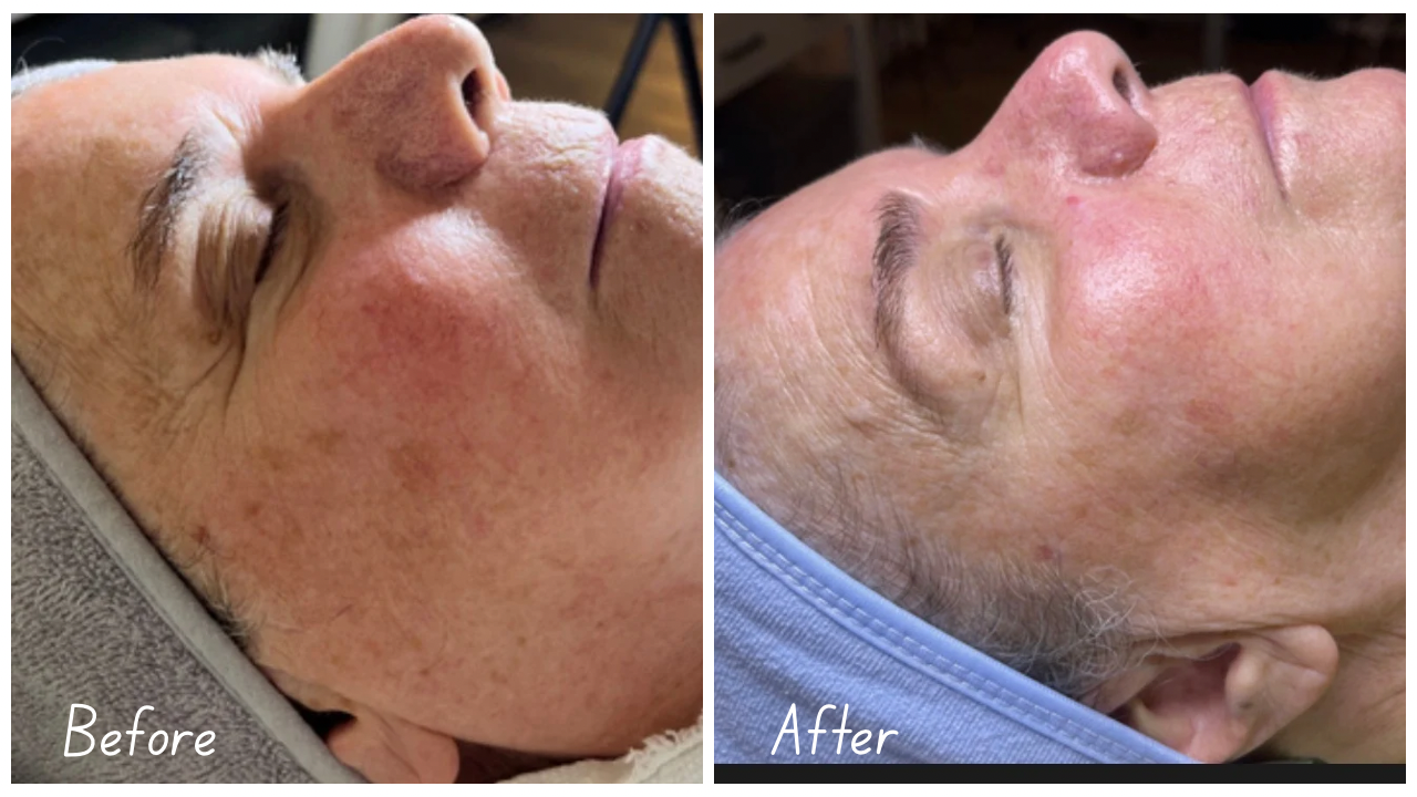 Before and After Youtube Thumbnail Cityscape (1).png