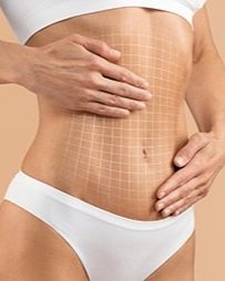 Abdominoplastie