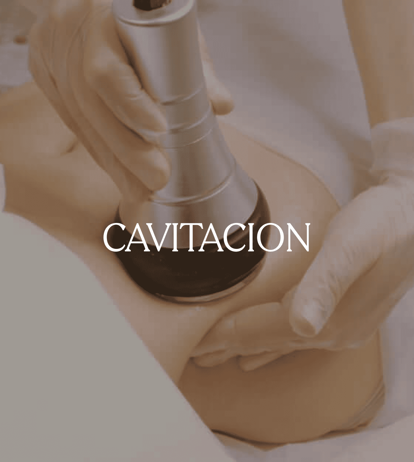CAVITACIÓN.png