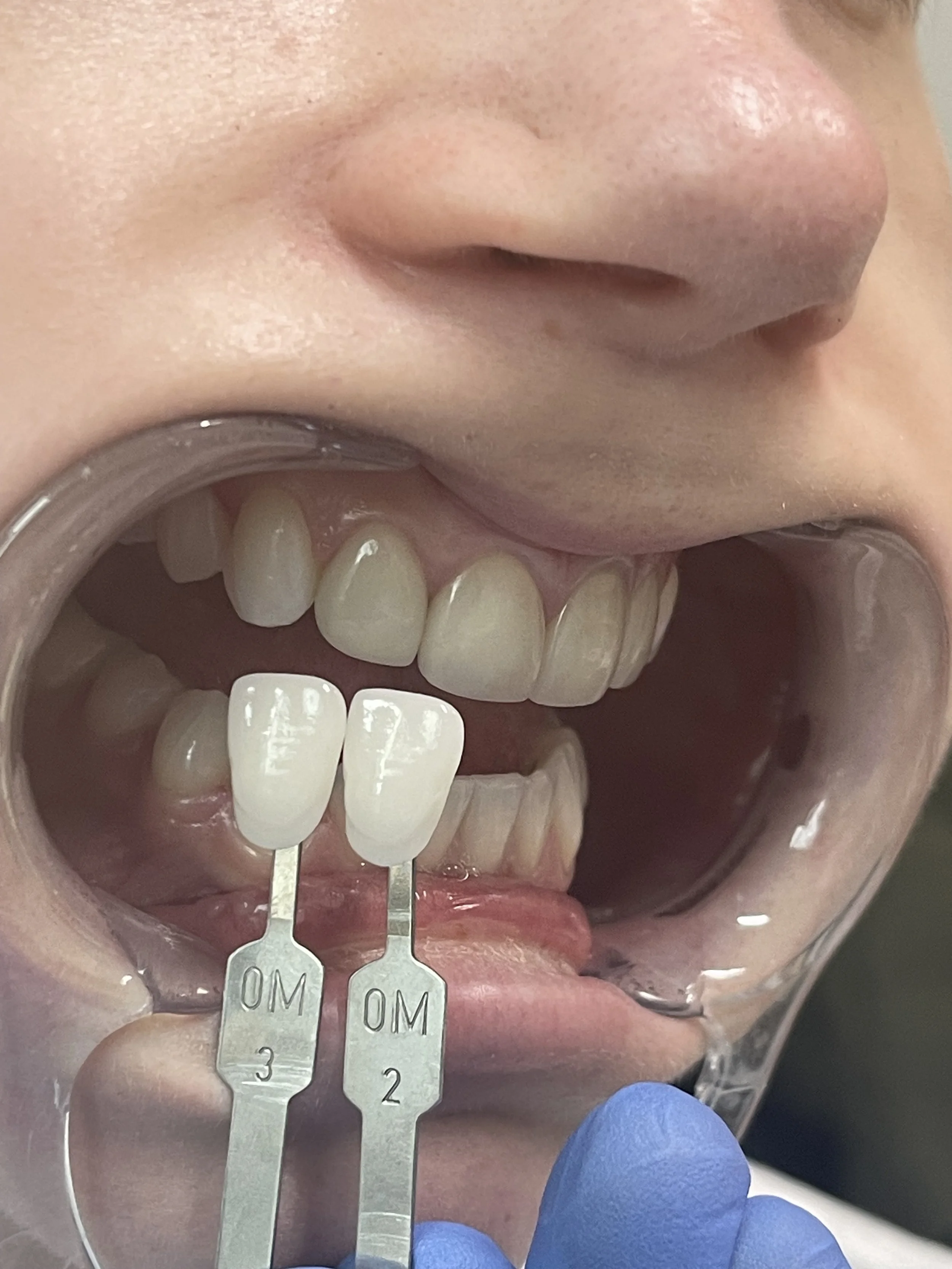 Calgary custom shade taking.