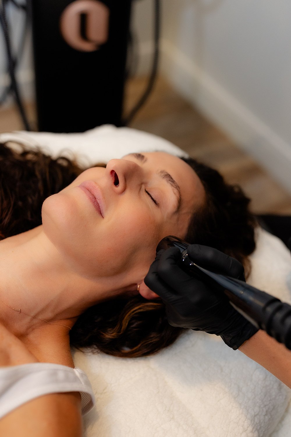 RF Microneedling, The Wellow Pittsburgh