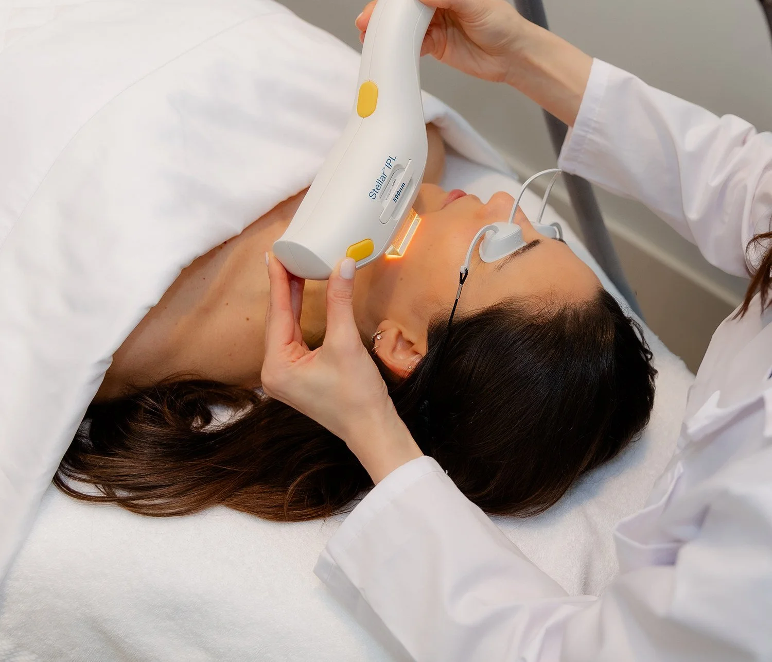 Stellar IPL Photofacial, The Wellow Pittsburgh