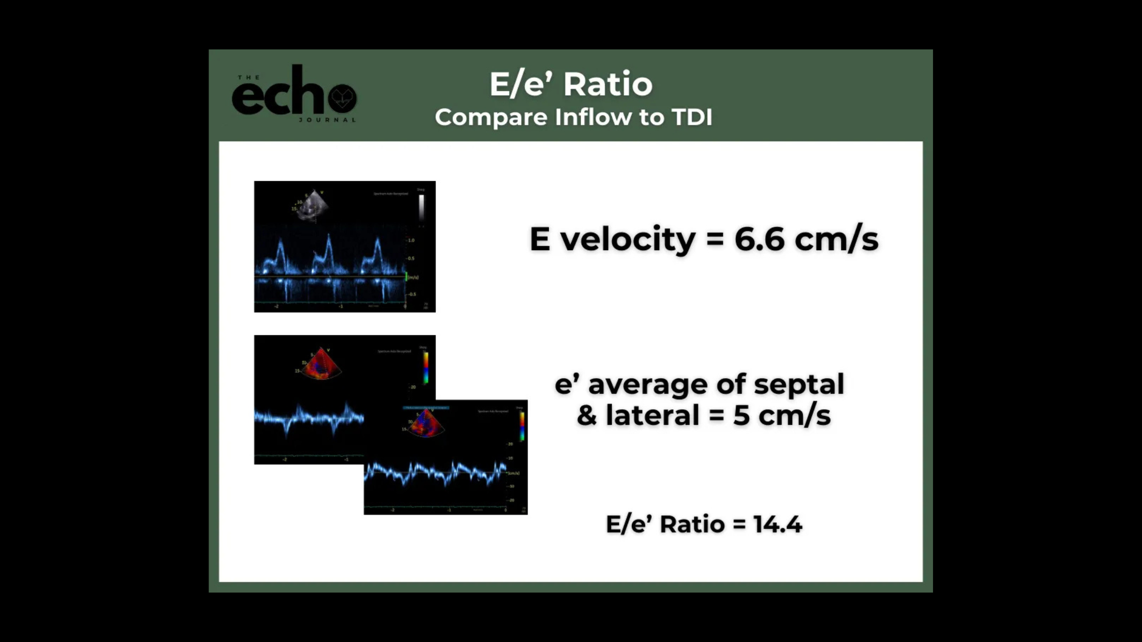 Diastology, Simplified