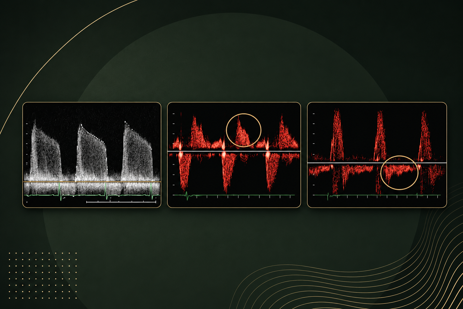 Spectral Doppler Settings Every Echo Student Should Know