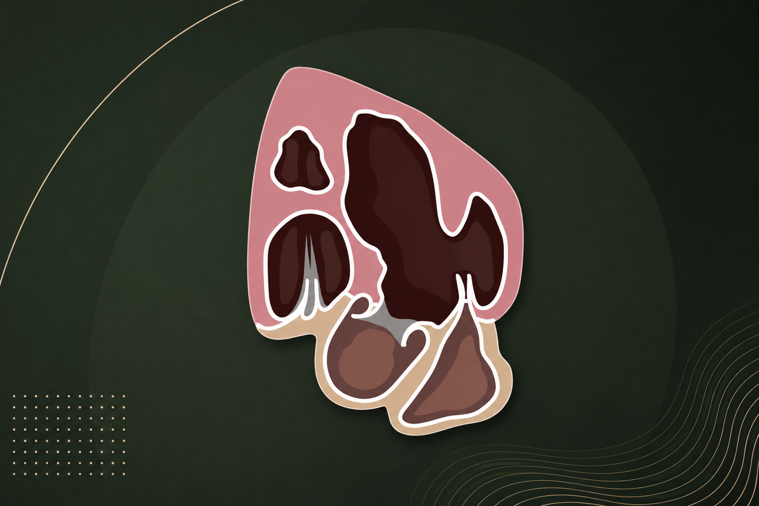 How to Get an Apical 5 Chamber View on Echocardiography