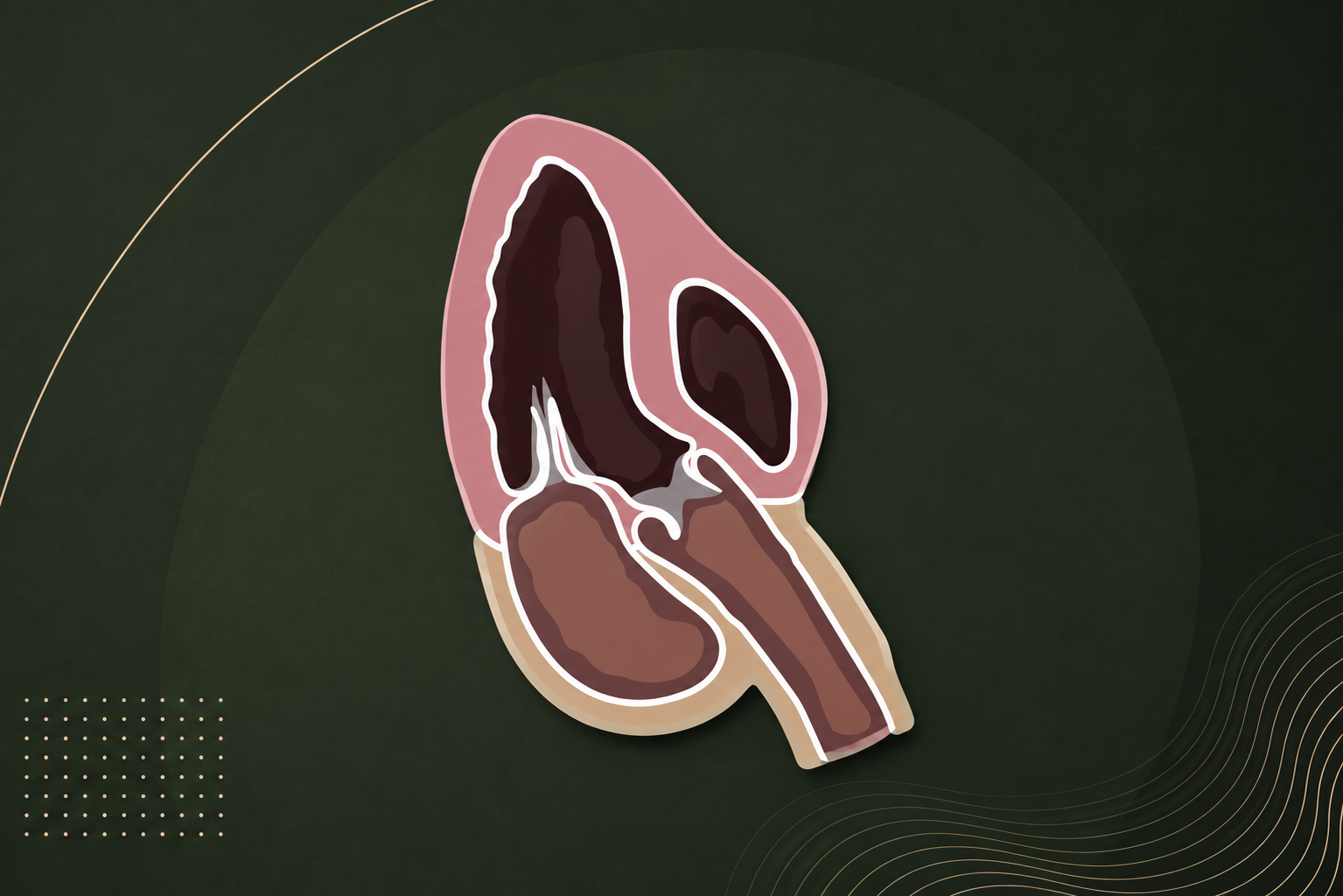How to Get an Apical 3 Chamber View on Echocardiography
