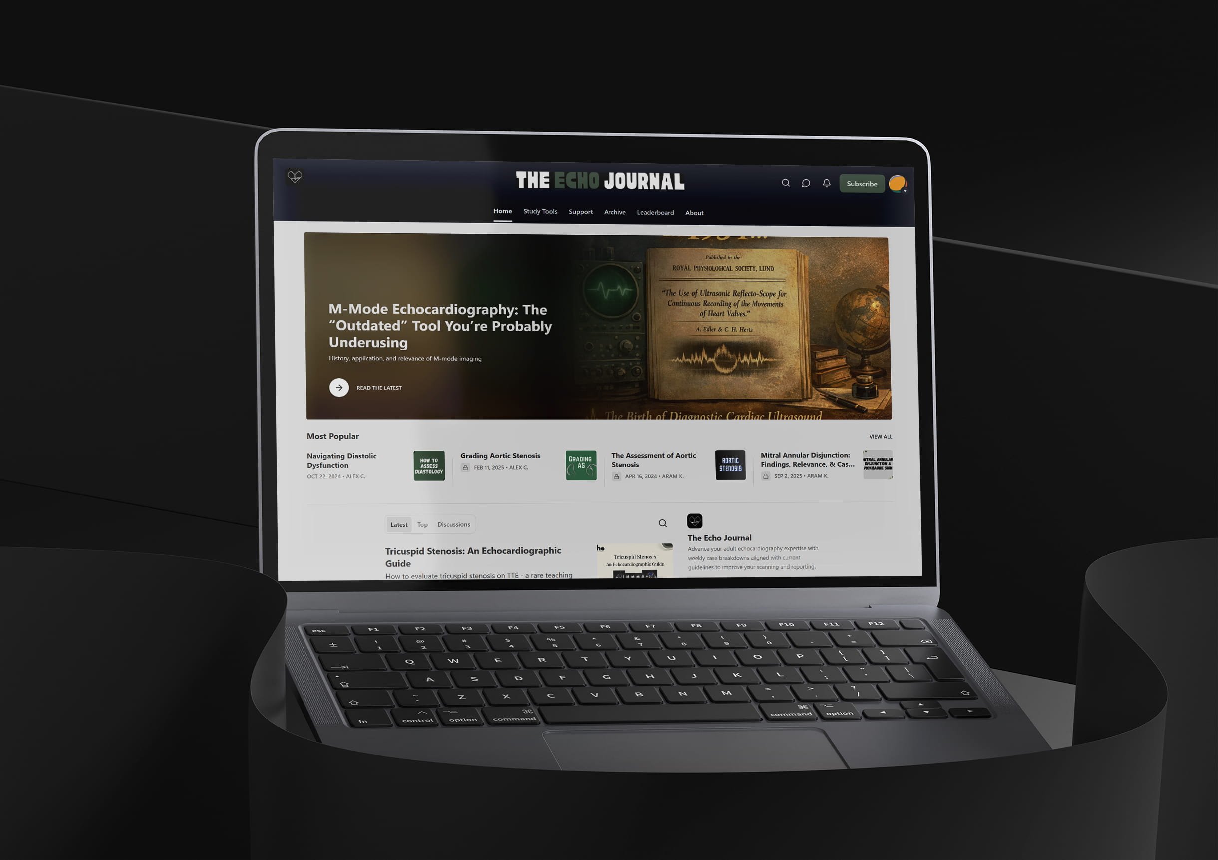 A laptop displaying 'The Echo Journal' website with articles on echocardiography in a dark setting.