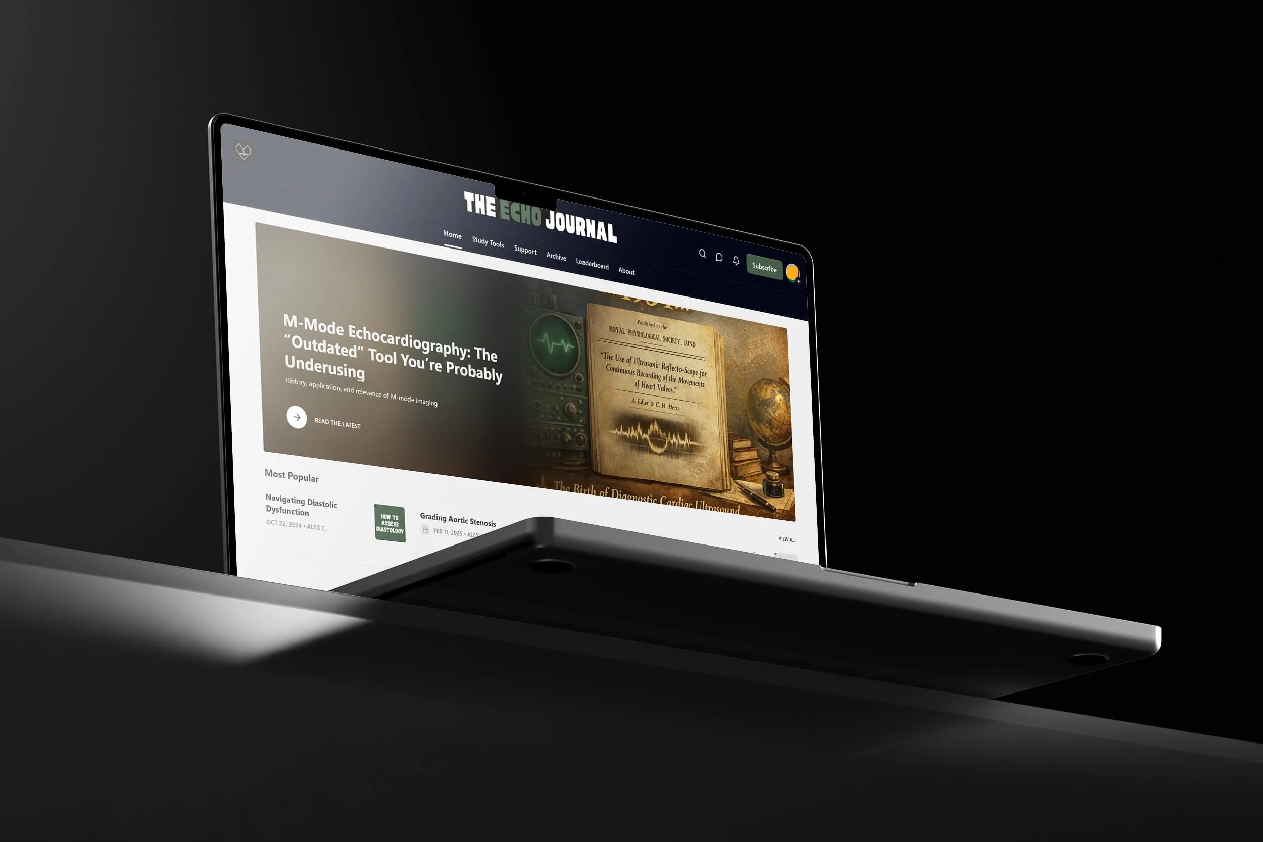 Laptop displaying The Echo Journal website with articles on echocardiography and medical topics, against a dark background.