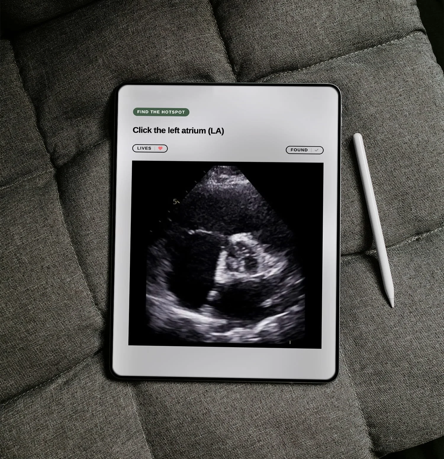 Tablet displaying an ultrasound image, resting on a gray fabric surface with a stylus beside it.