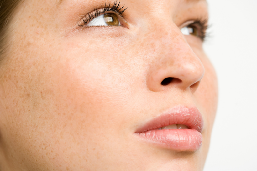 Close-up of a woman's face with clear skin and light freckles, looking slightly upward.