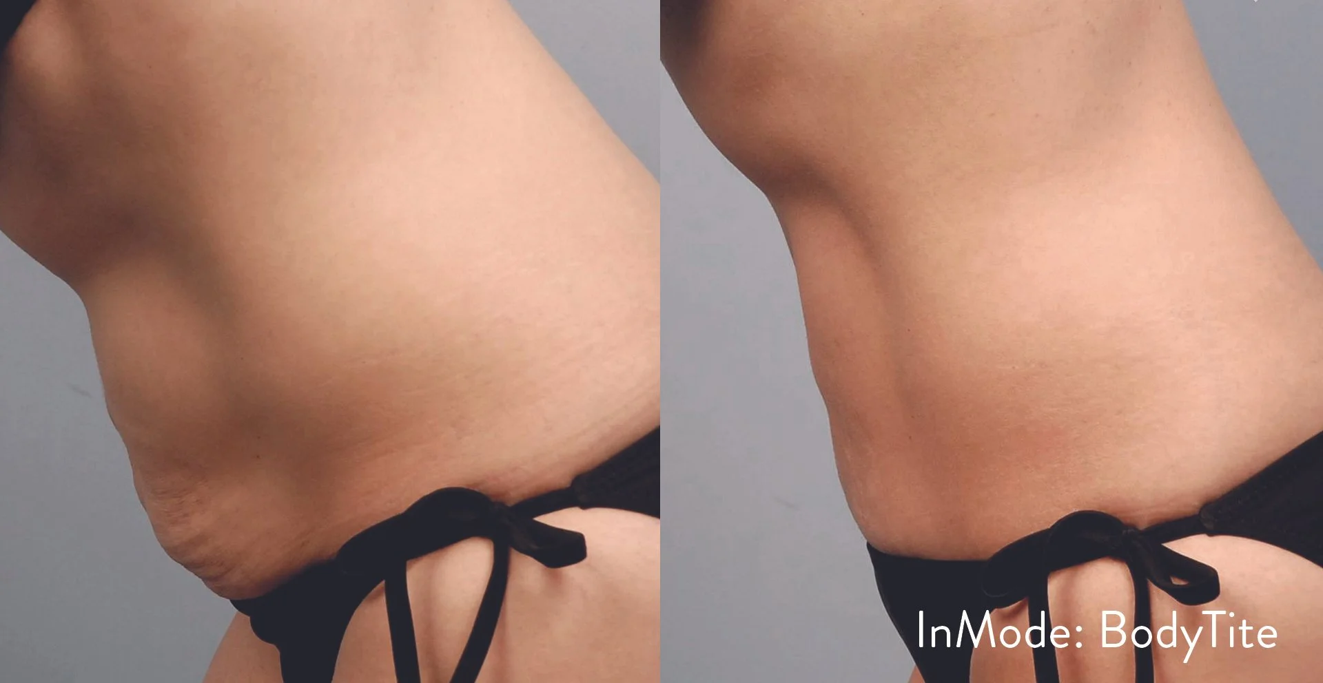 IM_SM_-MommyTummy.jpg