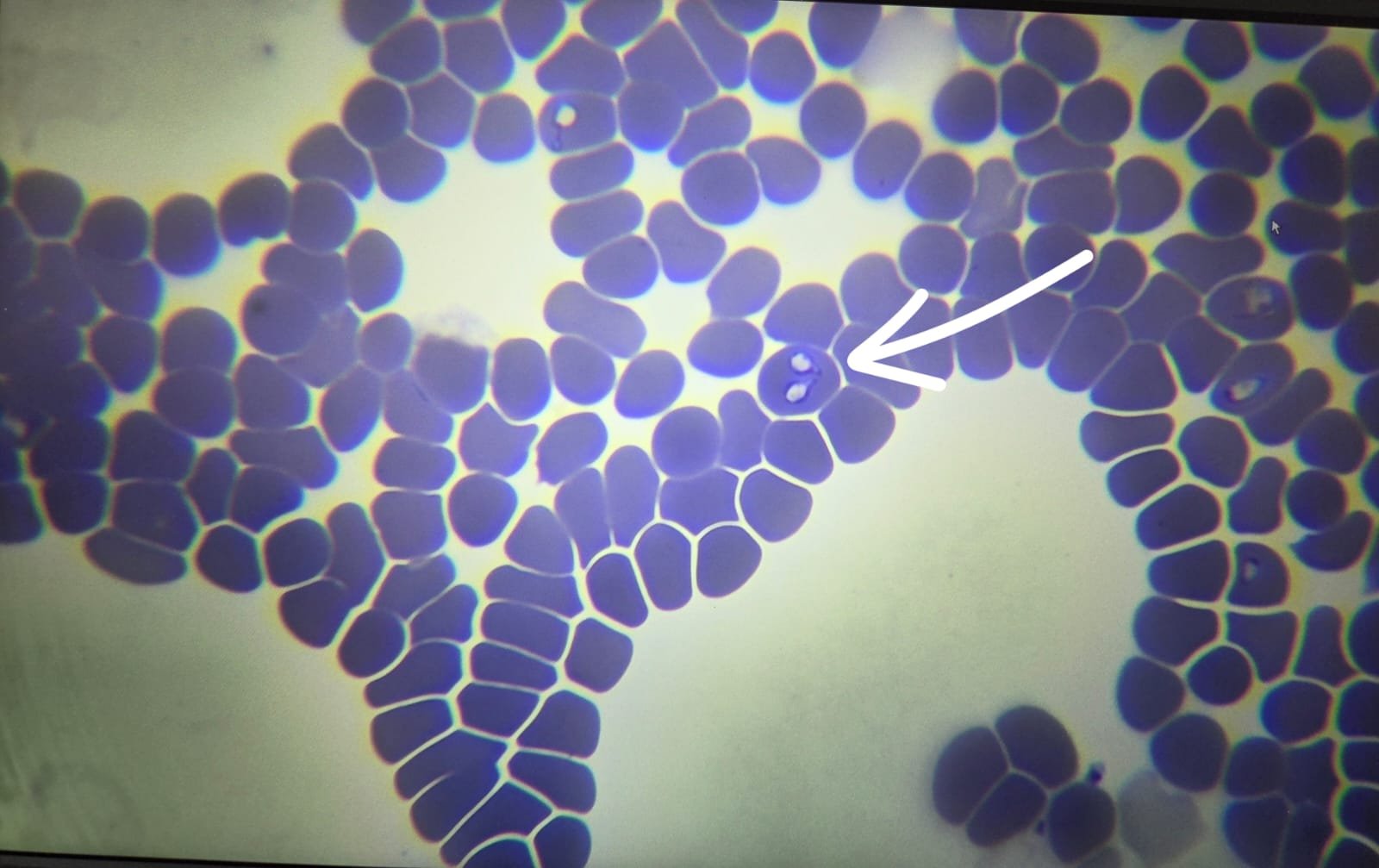 Babesioza la câini: o boală transmisă de căpușe&nbsp;care pune viața în pericol