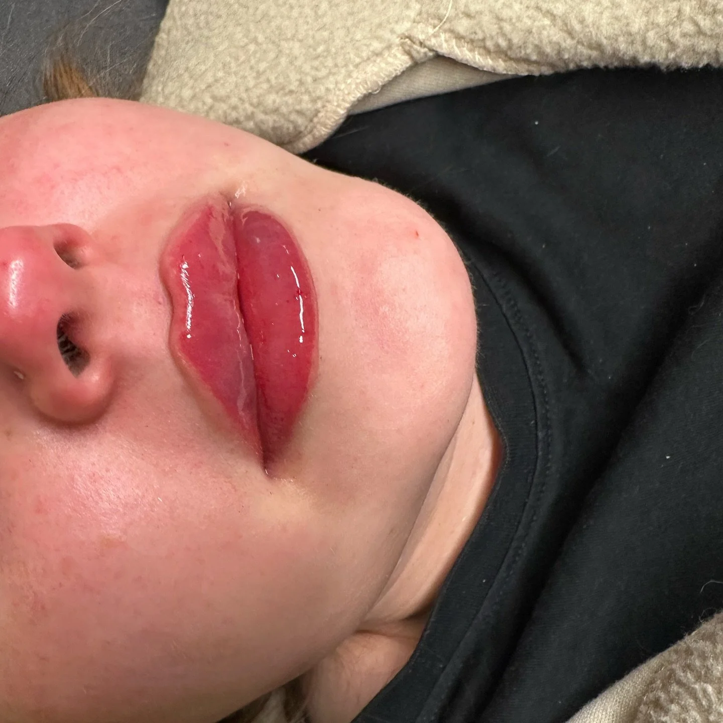 To have this natural lip colour BABE 😍

📍Haddington, East Lothian
𝐖𝐞𝐛𝐬𝐢𝐭𝐞: www.lmahaddington.co.uk
𝐁𝐨𝐨𝐤𝐢𝐧𝐠: https://lmahaddington.book.app/book-now
𝐄𝐦𝐚𝐢𝐥: info@lmathestudio.com

#lipfiller #lips #aesthetics #lma #beauty #dermalfi