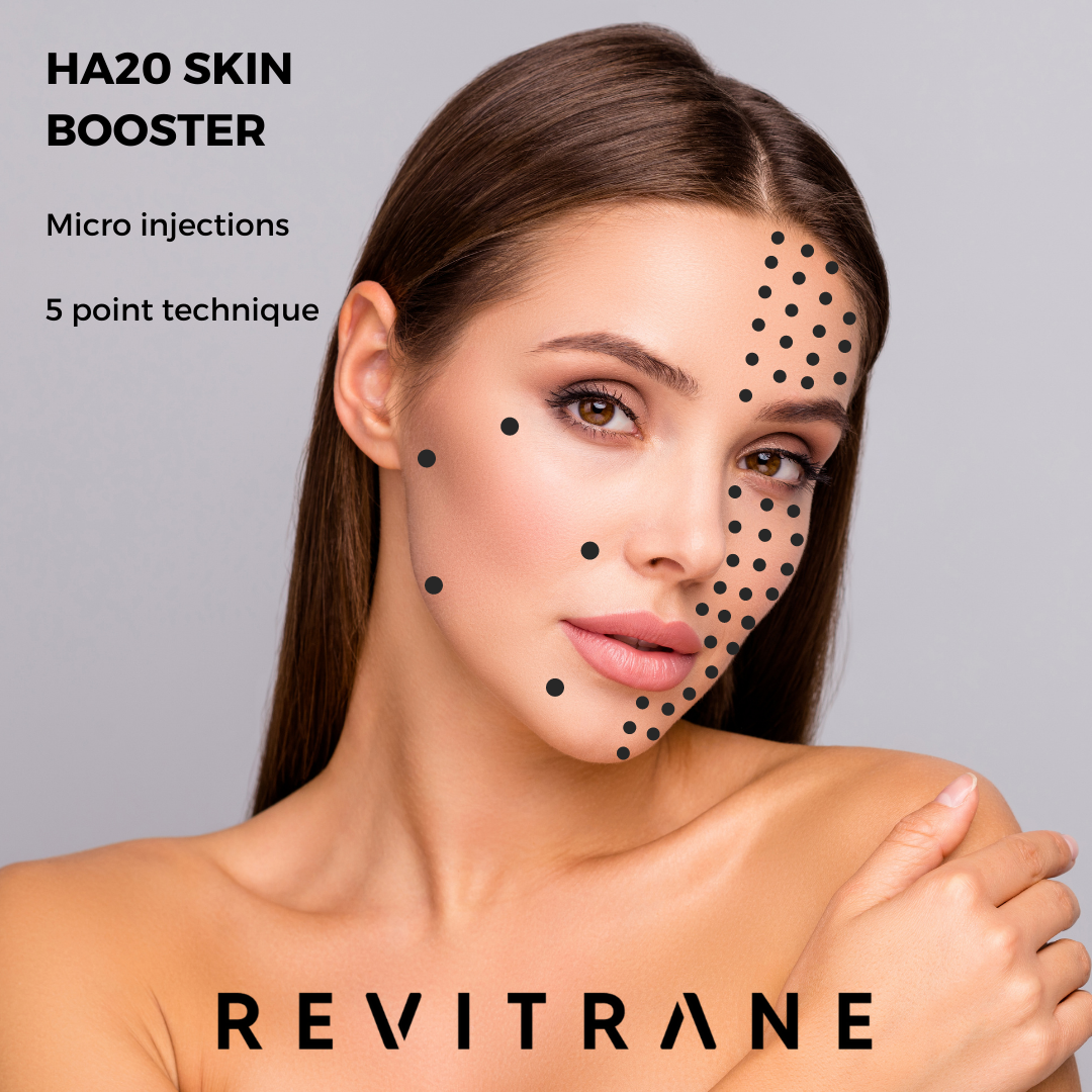 A woman with smooth skin and brown hair, with black dots indicating areas for skin treatment. Text on the image reads "HA20 SKIN BOOSTER," "Micro injections," "5 point technique," and "REVITANE."