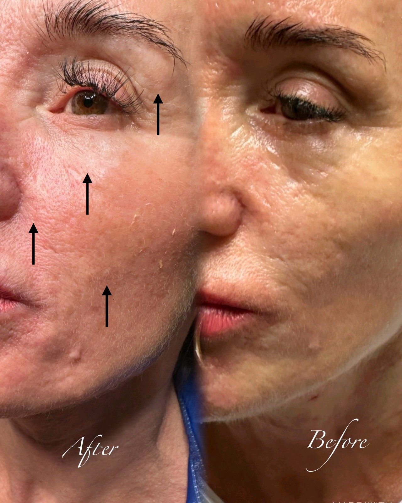 Facetune_28-04-2024-15-21-24.jpg