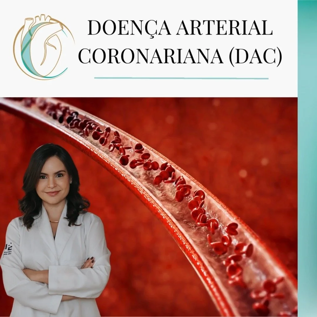 A doen&ccedil;a arterial coronariana (DAC) &eacute; uma condi&ccedil;&atilde;o caracterizada pela presen&ccedil;a de aterosclerose nas art&eacute;rias coron&aacute;rias, que pode levar a isquemia mioc&aacute;rdica e eventos cardiovasculares adversos.