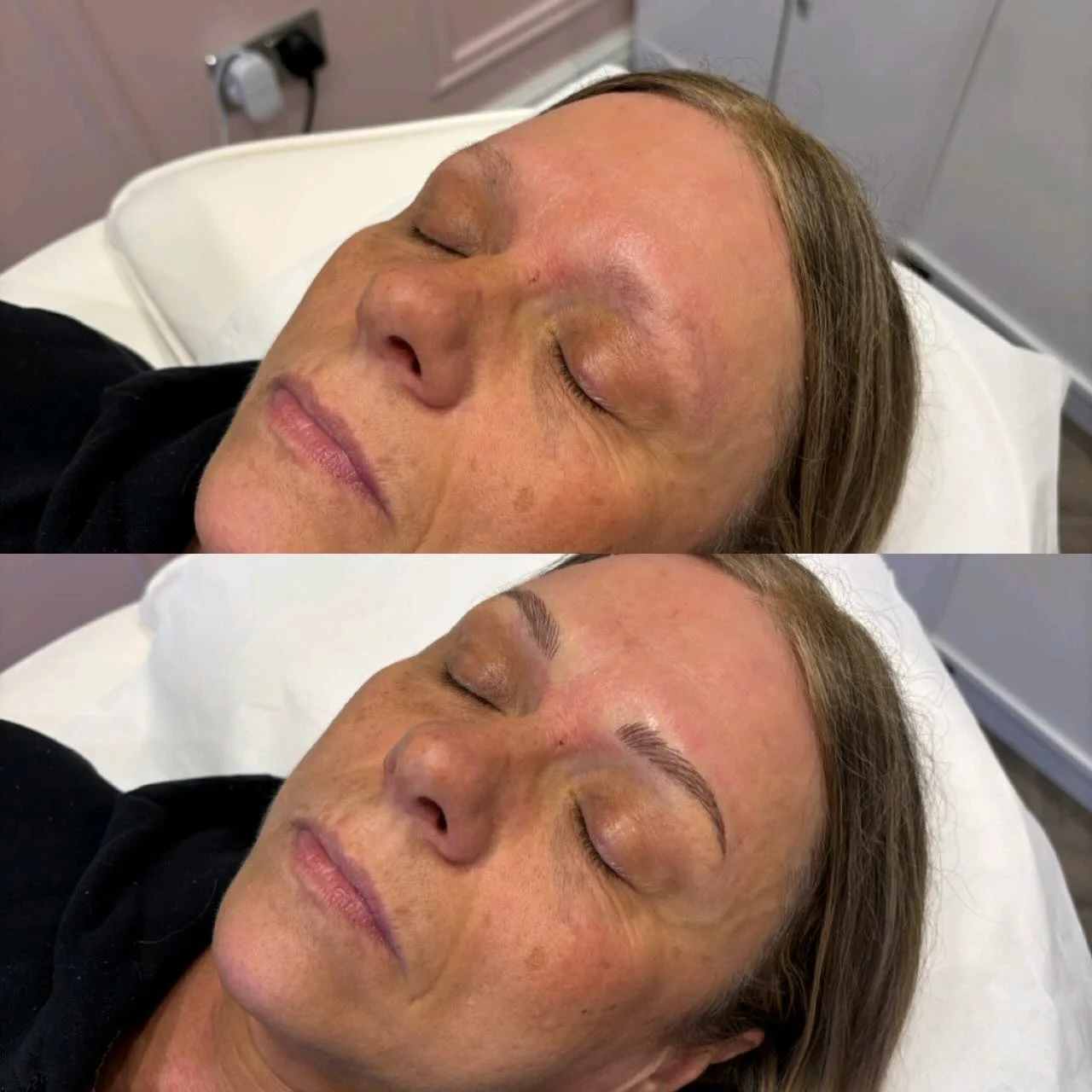 ✨ BROW TRANSFORMATION ✨

Say hello to effortless, natural-looking brows with Microblading 💫

This beautiful before &amp; after shows how we can enhance your natural shape, add definition, and create fuller-looking brows that frame your face perfectl