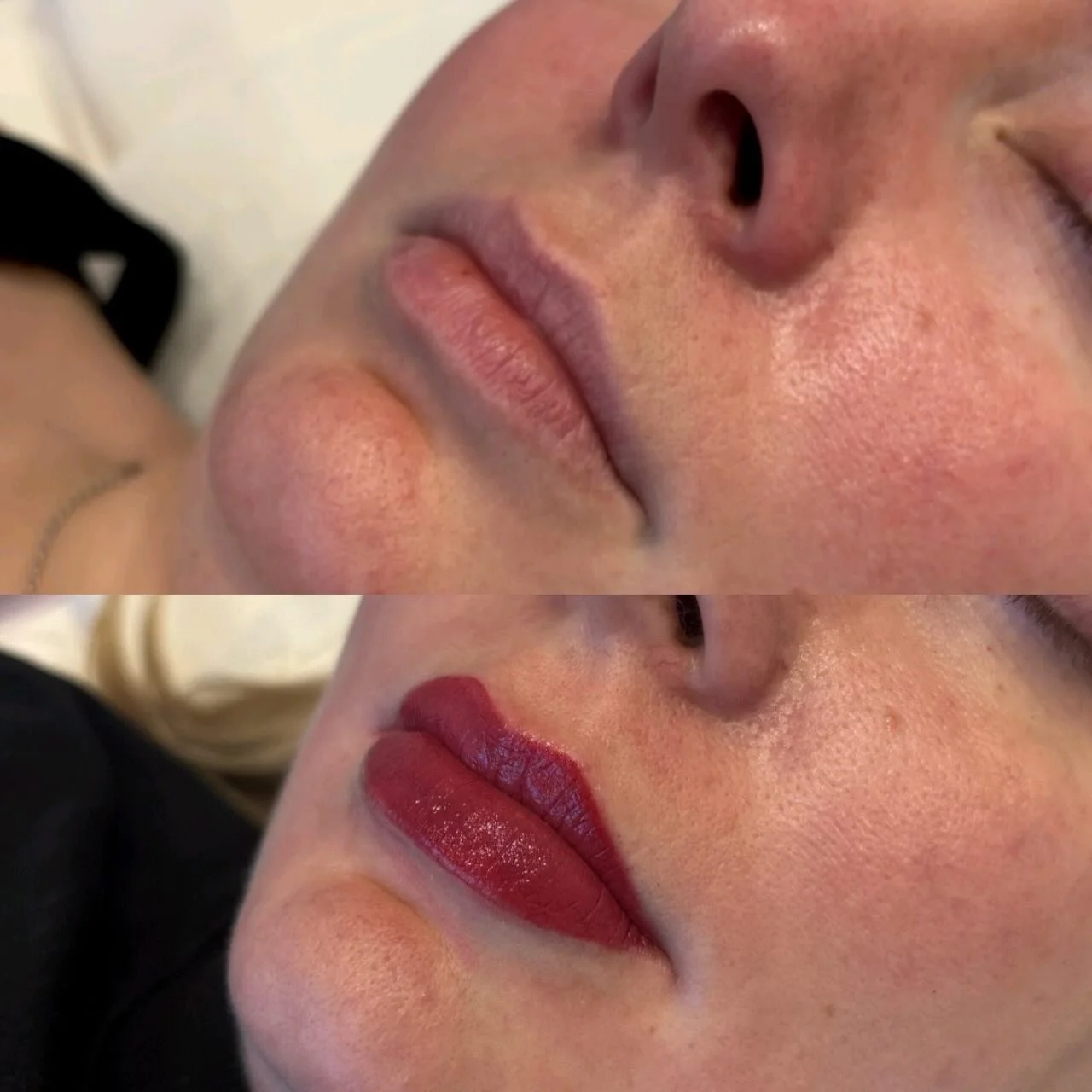 ✨ Trust the Process -  Here&rsquo;s Why the Initial Colour Looks So Bold ✨

Right after the treatment, the colour looks bold, rich, and super defined. That&rsquo;s because the pigment is freshly implanted and your lips are slightly swollen, which nat