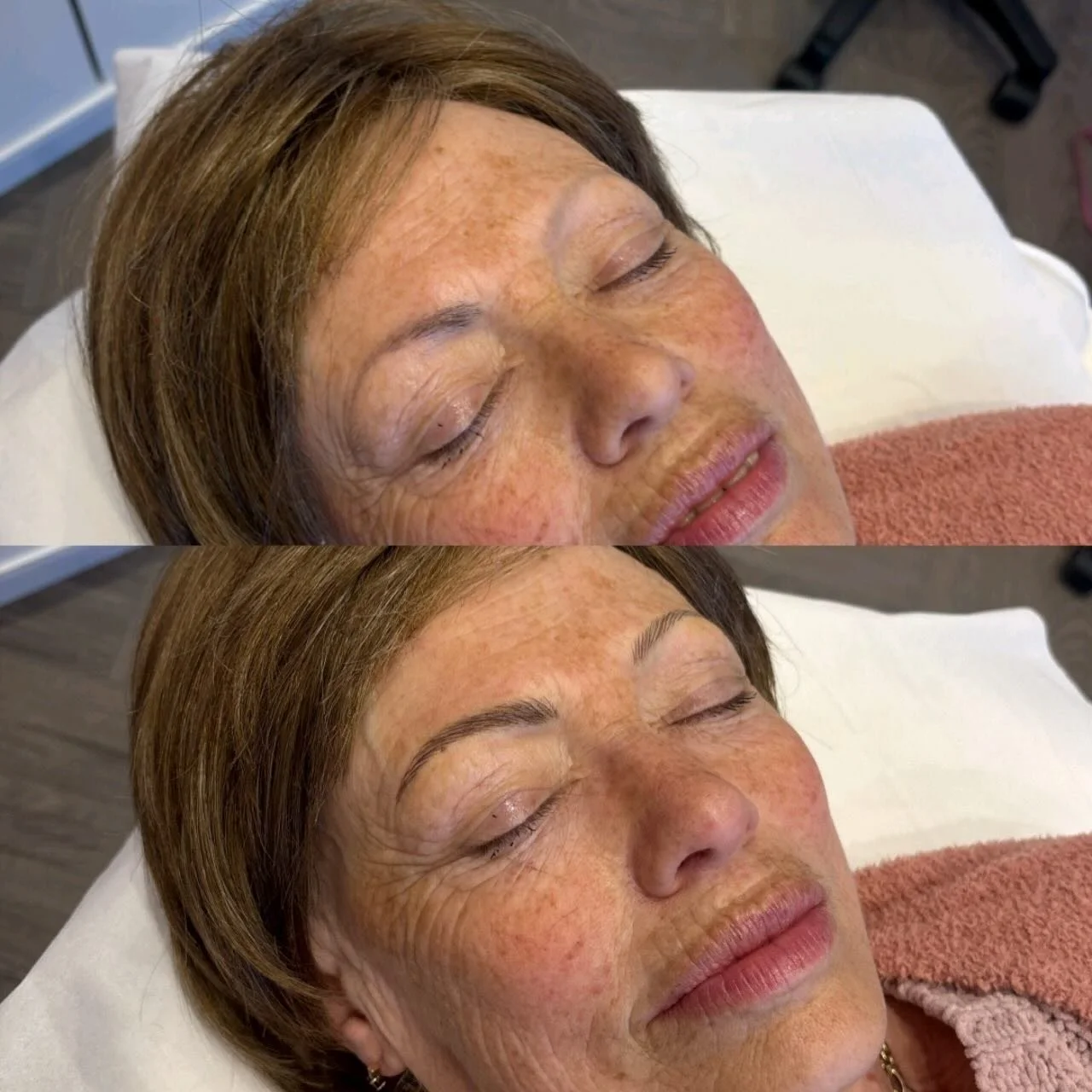 Some transformations mean more than beauty 🤍

This lovely client came to me after struggling with hair loss, which had sadly affected her eyebrows. In the top &ldquo;before&rdquo; photos, you can see that one eyebrow had very little natural hair rem