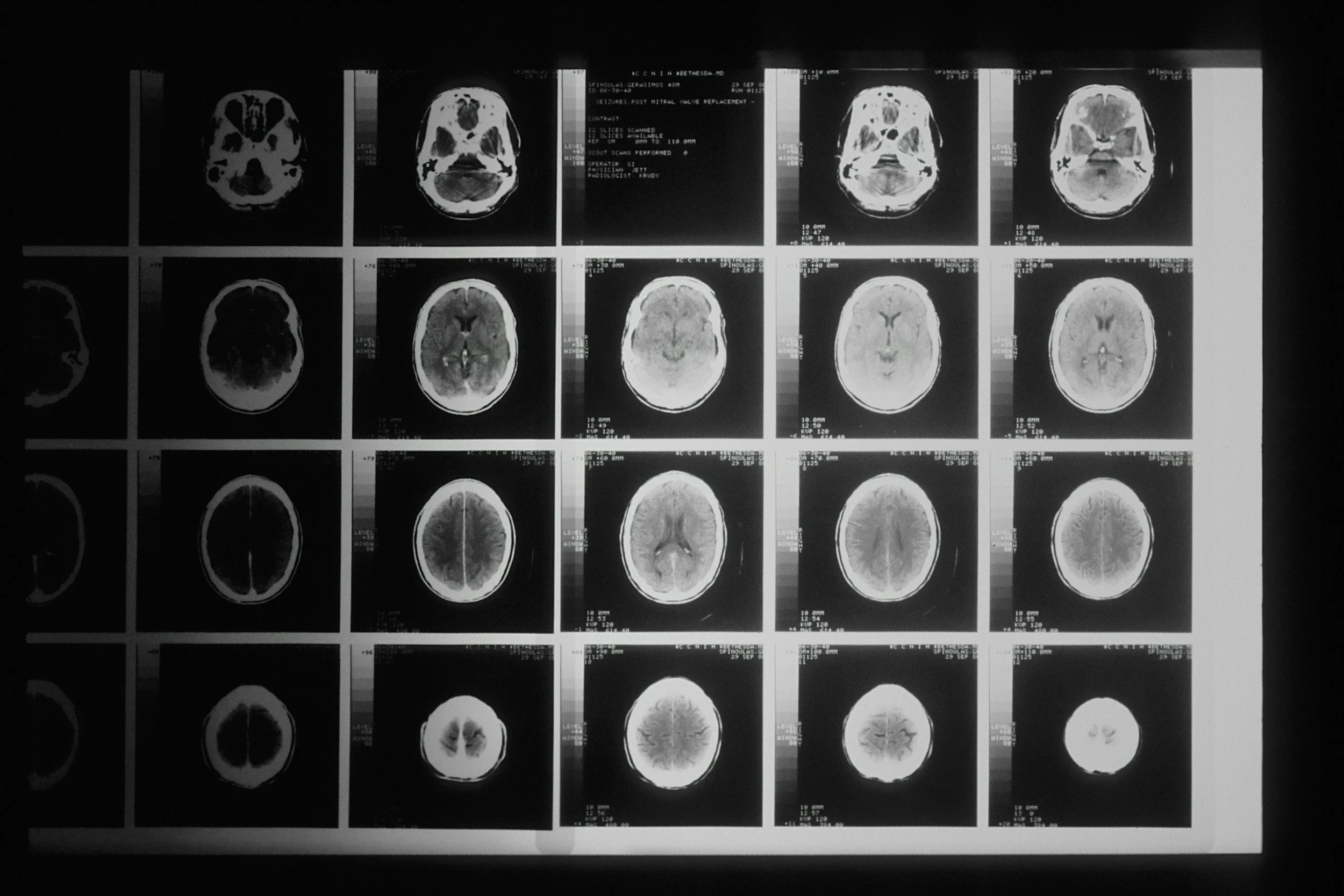 brain imaging 