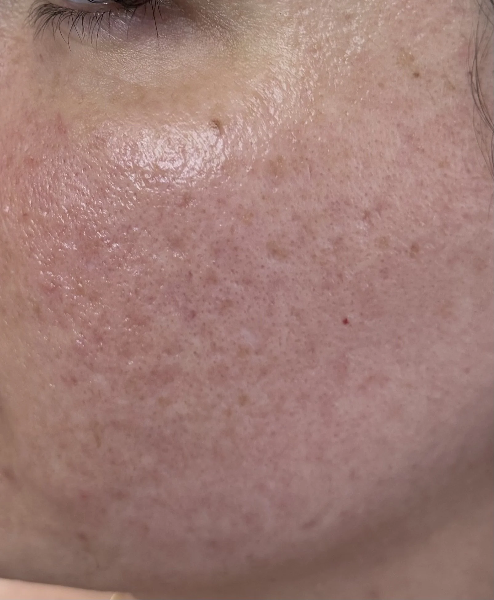 Uneven texture
