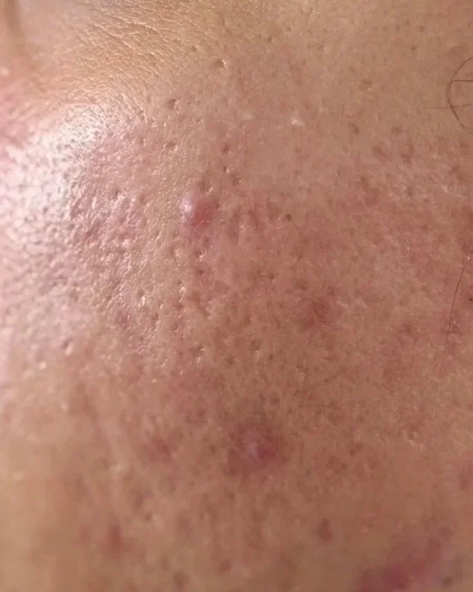 C2363395-BD52-42DD-AC59-731F838D691A.jpg