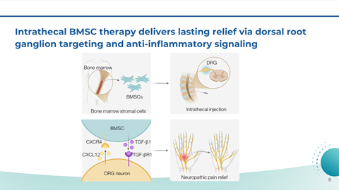 Infographic explaining intrathecal BMSC therapy for pain relief, showing bone marrow stromal cells, injection process, and nerve pain relief mechanisms.